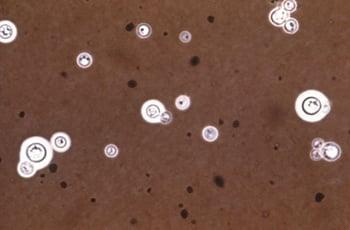 Tuschefleck (Cryptococcus neoformans)