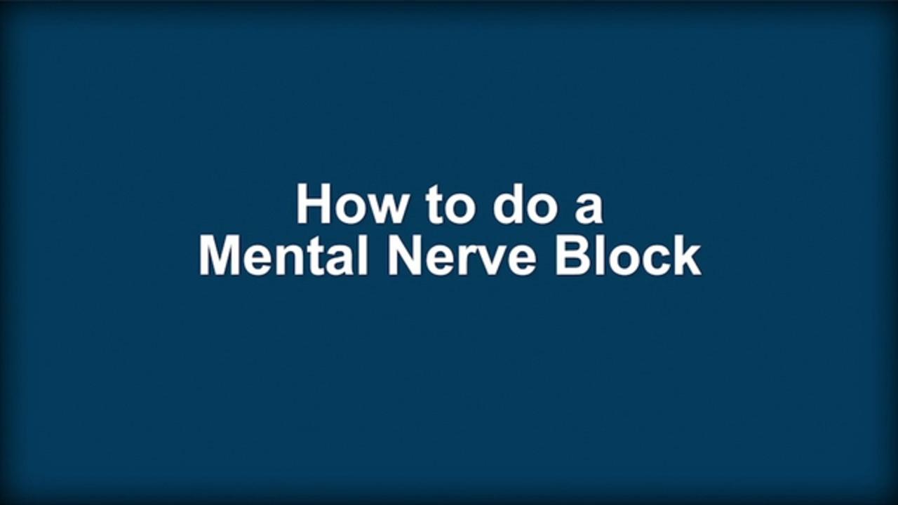 Comment effectuer un bloc du nerf mental (mentonnier)
