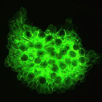 Coloration fluorescente (Pneumocystis jirovecii)
