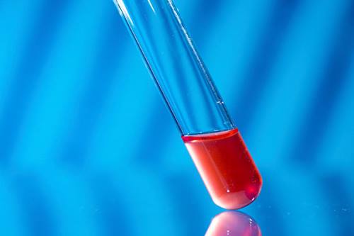 Commentary: Avoiding the vowels in pursuit of good laboratory stewardship: AEIOU…..And always “Why”