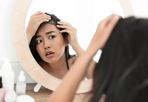 Commentary: What is Alopecia? 6 Things People Get Wrong About Hair Loss