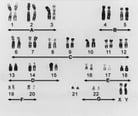 Genes and Chromosomes
