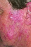 Skin and mucous membrane problems