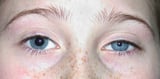 Some Causes and Features of Unequal Pupils