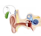 Management of Hearing Loss
