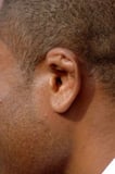 Ear Injury