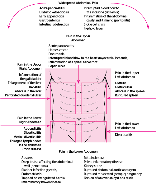Causes of Abdominal Pain by Location