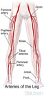 Overview of Peripheral Arterial Disease