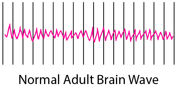 Recording Brain Activity