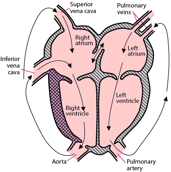 Transposition of the Great Arteries