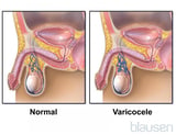 Some Causes and Features of Scrotal Swelling