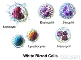 Overview of White Blood Cell Disorders