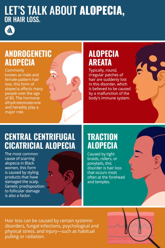 Let’s Talk About Alopecia 