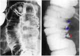 X-Ray and Other Imaging Contrast Studies of the Gastrointestinal Tract