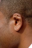 External Ear Trauma