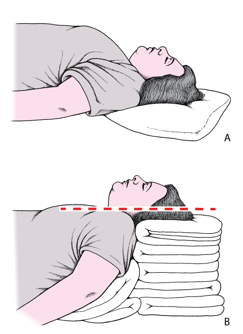 Head and neck positioning to open the airway: Sniffing position