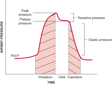 Components of airway pressure during mechanical ventilation, illustrated by an inspiratory-hold maneuver