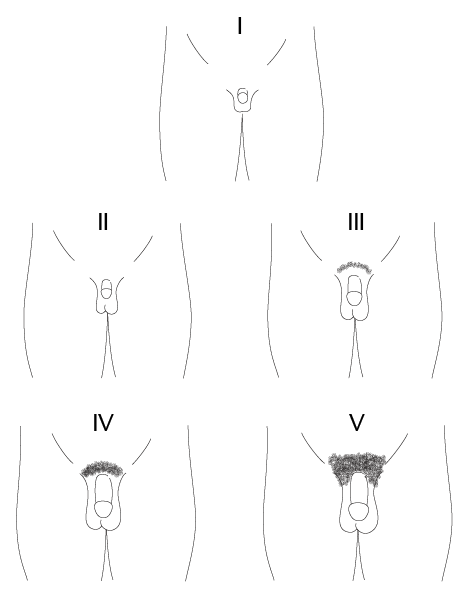 Diagrammatic representation of Tanner stages I to V of penis maturation in boys