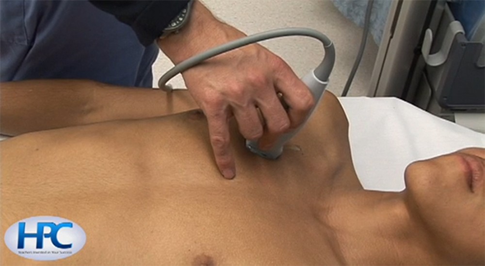 eFAST: extended Focused Assessment with Sonography in Trauma 