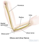 Peroneal nerve palsy