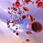 Iron Deficiency Anemia