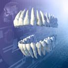Affections liées aux implants dentaires