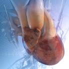 Canalopathies cardiaques