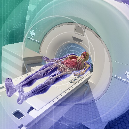 Radionuclide Scanning Special Subjects Merck Manuals Consumer Version