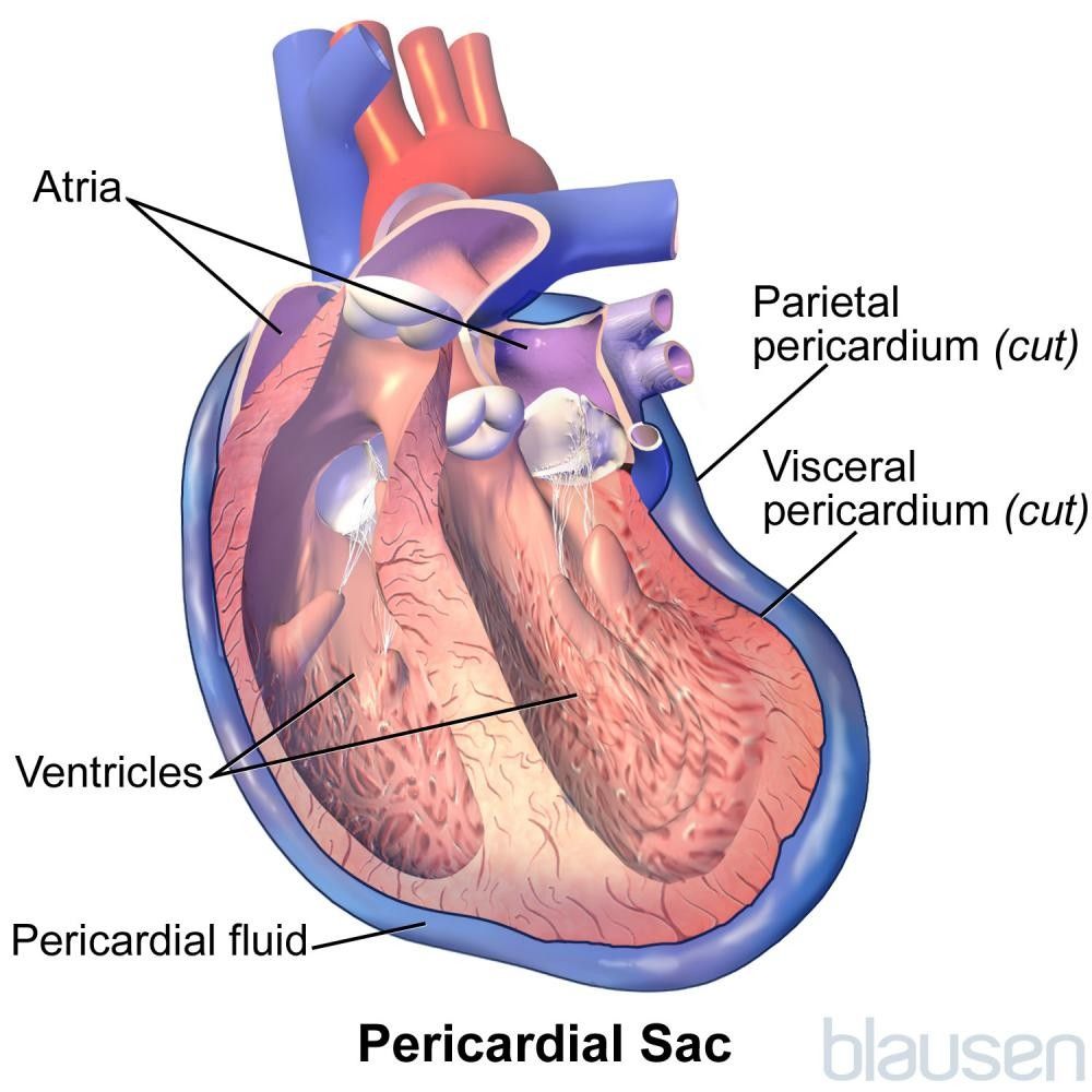 Acute Pericarditis - Heart and Blood Vessel Disorders - Merck Manuals Consumer Version