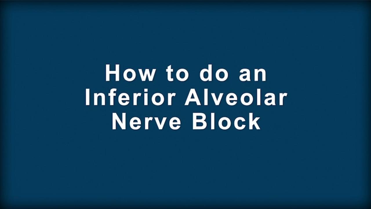 Comment effectuer un bloc nerveux alvéolaire inférieur